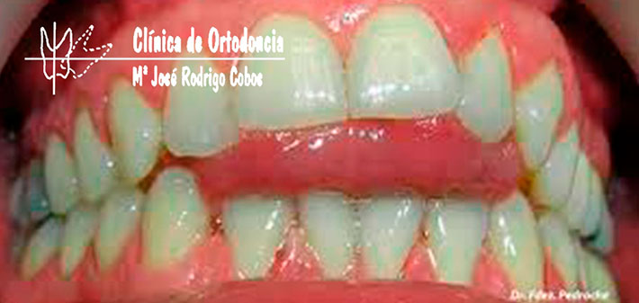 Ortodoncia y Logopedia