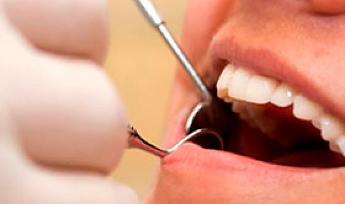 futuro escudo frente a la caries